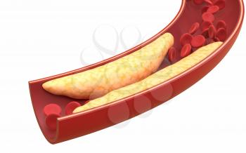 Fat and red blood cells in blood vessels, 3d rendering. Computer digital drawing.