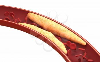 Fat and red blood cells in blood vessels, 3d rendering. Computer digital drawing.