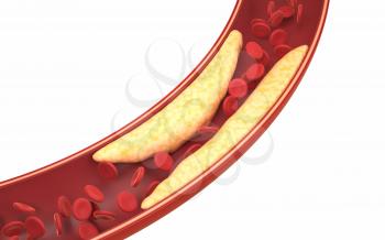 Fat and red blood cells in blood vessels, 3d rendering. Computer digital drawing.