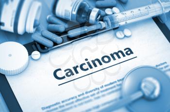 Carcinoma - Printed Diagnosis with Blurred Text. Diagnosis - Carcinoma on Background of Medicaments Composition - Pills, Injections and Syringe. 3D.