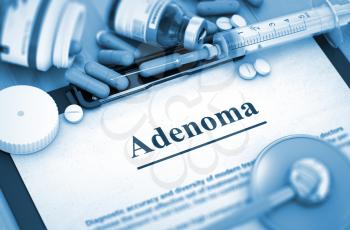 Adenoma Diagnosis, Medical Concept. Composition of Medicaments. Adenoma, Medical Concept with Selective Focus. Adenoma, Medical Concept with Pills, Injections and Syringe. 3D.