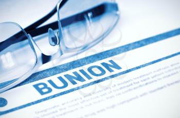 Bunion - Medical Concept with Blurred Text and Specs on Blue Background. Selective Focus. 3D Rendering.