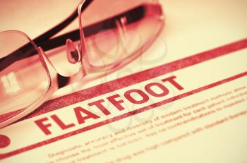Flatfoot - Medical Concept with Blurred Text and Eyeglasses on Red Background. Selective Focus. Flatfoot - Medical Concept on Red Background with Blurred Text and Composition of Specs. 3D Rendering.