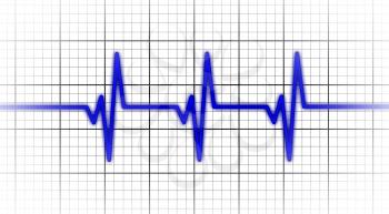 Electrocardiogram - Concept of healthcare, heartbeat shown on monitor - blue