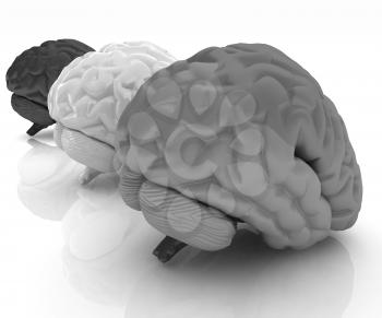 Human brains