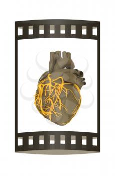 Human heart