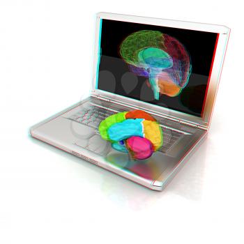 creative three-dimensional model of real human brain and scan on a digital laptop. 3d render. Anaglyph. View with red/cyan glasses to see in 3D.