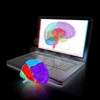 creative three-dimensional model of real human brain and scan on a digital laptop. 3d render. Anaglyph. View with red/cyan glasses to see in 3D.