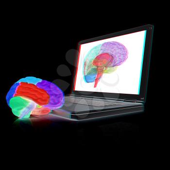 creative three-dimensional model of real human brain and scan on a digital laptop. 3d render. Anaglyph. View with red/cyan glasses to see in 3D.