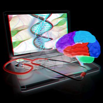 Laptop, brain and Stethoscope. 3d illustration. Anaglyph. View with red/cyan glasses to see in 3D.