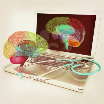 Laptop, brain and Stethoscope. 3d illustration