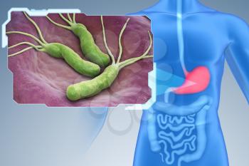 Helicobacter Pylori is a Gram-negative, microaerophilic bacterium found in the stomach. 3D illustration