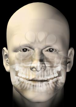 Male figure portrait with dental scan x-ray. 3d computer generated illustration.