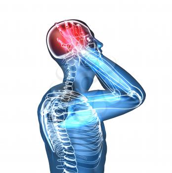 Royalty Free 3d Clipart Image of a Body With a Headache