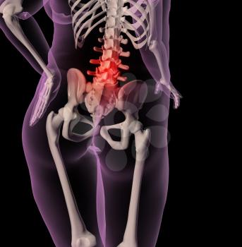 3D render of a medical skeleton showing an overweight female with back pain