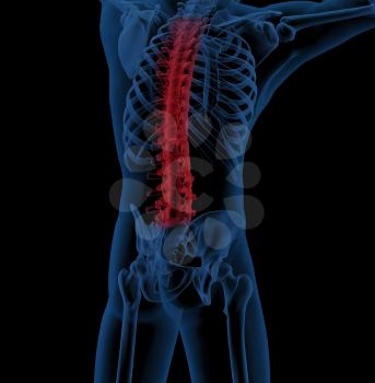 3D render of a male medical skeleton with the spine highlighted indicating back pain