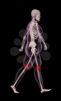 3D render of an overweight female medical skeleton walking with knee joints highlighted