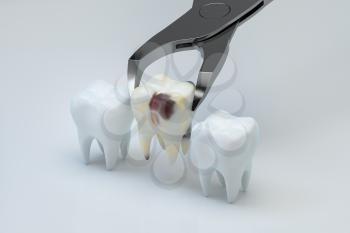 The sick tooth being pulled out, 3d rendering. Computer digital drawing.
