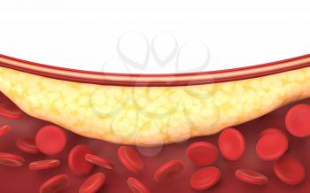 Fat and red blood cells in blood vessels, 3d rendering. Computer digital drawing.