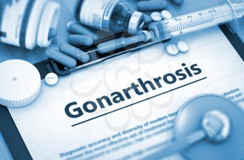Gonarthrosis - Medical Report with Composition of Medicaments - Pills, Injections and Syringe. 3D Render. Toned Image.