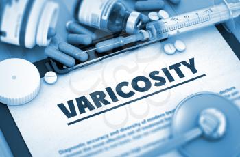 Varicosity, Medical Concept with Selective Focus. Varicosity - Printed Diagnosis with Blurred Text. 3D. Toned Image. 