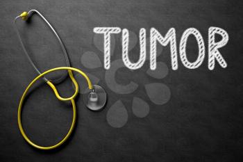 Tumor. Medical Concept, Handwritten on Black Chalkboard. Top View Composition with Chalkboard and Yellow Stethoscope. Medical Concept: Black Chalkboard with Tumor. 3D Rendering.
