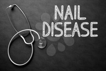 Medical Concept: Nail Disease - Medical Concept on Black Chalkboard. Black Chalkboard with Nail Disease - Medical Concept. 3D Rendering.