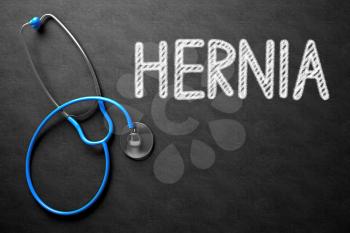 Medical Concept: Hernia Handwritten on Black Chalkboard. Top View of Blue Stethoscope on Chalkboard. Black Chalkboard with Hernia - Medical Concept. 3D Rendering.