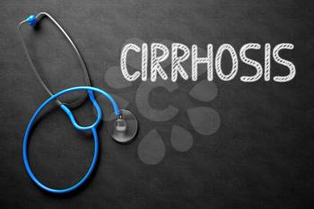 Medical Concept: Cirrhosis -  Black Chalkboard with Hand Drawn Text and Blue Stethoscope. Top View. Medical Concept: Cirrhosis - Text on Black Chalkboard with Blue Stethoscope. 3D Rendering.