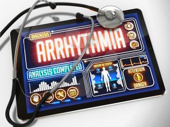 Arrhythmia- Diagnosis on the Display of Medical Tablet and a Black Stethoscope on White Background.