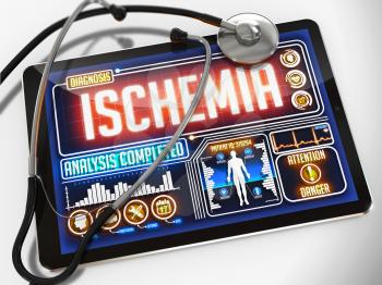 Ischemia - Diagnosis on the Display of Medical Tablet and a Black Stethoscope on White Background.