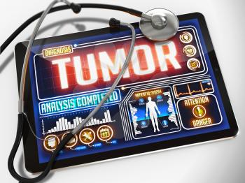 Tumor - Diagnosis on the Display of Medical Tablet and a Black Stethoscope on White Background.
