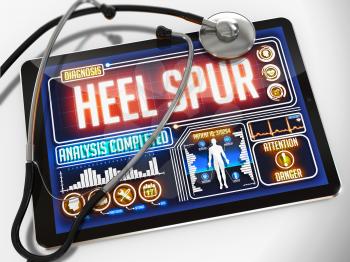 Royalty Free Clipart Image of Heel Spur Diagnosis on a Tablet