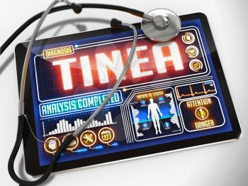 Tinea - Diagnosis on the Display of Medical Tablet and a Black Stethoscope on White Background.