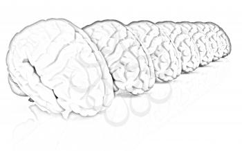 Human brains