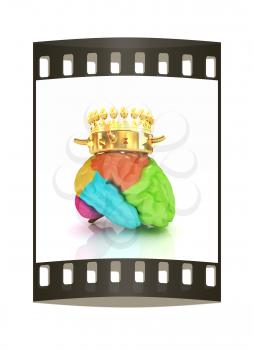 Gold Crown on the brain. The film strip