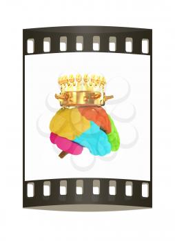 Gold Crown on the brain. The film strip