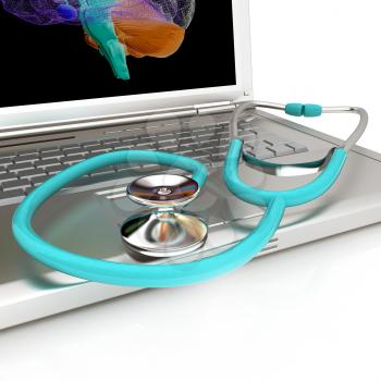 Laptop, brain and Stethoscope. 3d illustration