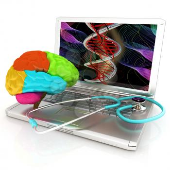Laptop, brain and Stethoscope. 3d illustration