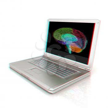 creative three-dimensional model of  human brain scan on a digital laptop. 3d render. Anaglyph. View with red/cyan glasses to see in 3D.