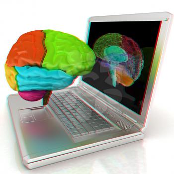 creative three-dimensional model of real human brain and scan on a digital laptop. 3d render. Anaglyph. View with red/cyan glasses to see in 3D.