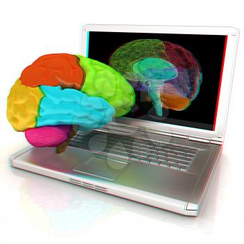 creative three-dimensional model of real human brain and scan on a digital laptop. 3d render. Anaglyph. View with red/cyan glasses to see in 3D.