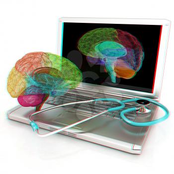 Laptop, brain and Stethoscope. 3d illustration. Anaglyph. View with red/cyan glasses to see in 3D.