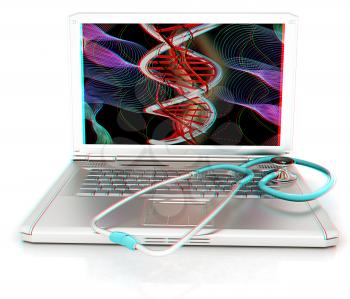 silver laptop diagnosis with stethoscope. 3D illustration. Anaglyph. View with red/cyan glasses to see in 3D.