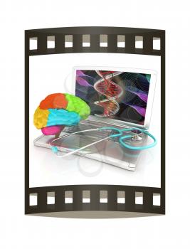 Laptop, brain and Stethoscope. 3d illustration. The film strip