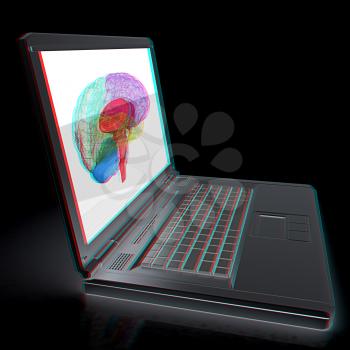 creative three-dimensional model of  human brain scan on a digital laptop. 3d render. Anaglyph. View with red/cyan glasses to see in 3D.