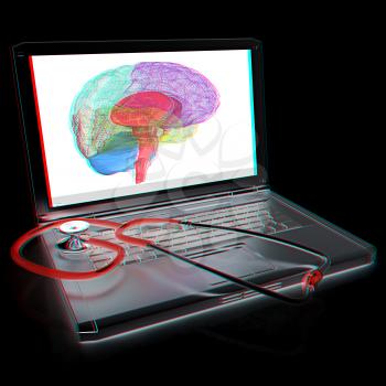 Laptop, brain and Stethoscope. 3d illustration. Anaglyph. View with red/cyan glasses to see in 3D.