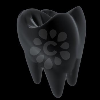 Metal tooth. 3d illustration. On a black background.