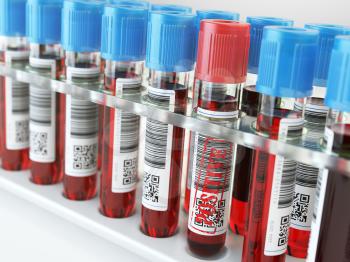 Blood sample positive and many others blood test tubes in a rack. 3d illustration