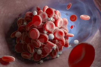 Depiction of a blood clot forming inside a blood vessel. 3D illustration
